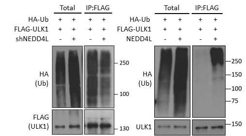 NEDD4L에의한 ULK1의 Ubiquitination의 조절