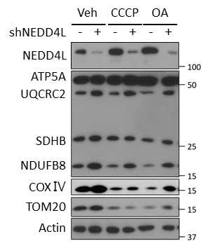 NEDD4L 결핍조건에서 미토콘드리아 OXPHOS complex I/III의 축적 및 유지