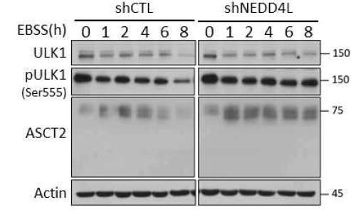 NEDD4L 결핍조건에서 glutamine transporter의 축적 현상