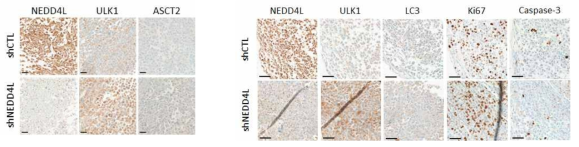 NEDD4L 결핍된 췌장암세포를 이용한 Xenograft 마우스 모델 암조직에서의 하위기질들과 autophagy marker level측정