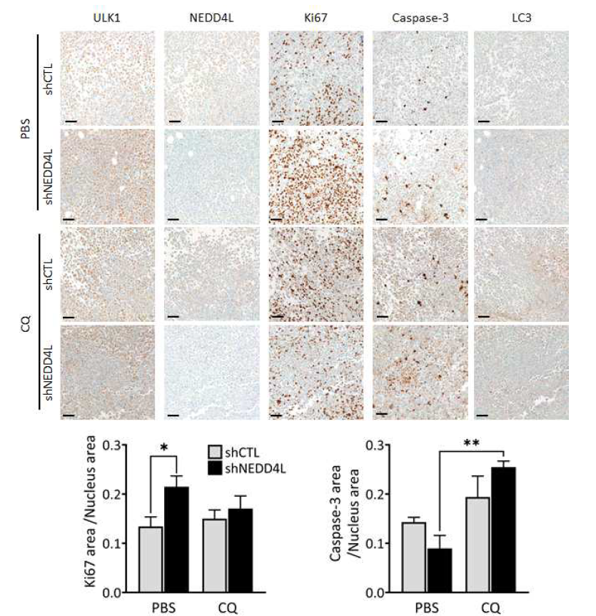 NEDD4L 결핍된 췌장암세포를 이용한 Xenograft in vivo실험에서에서 autophagy 억제를 통한 항암작용