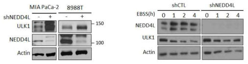 NEDD4L의 ULK1 stability 조절현상