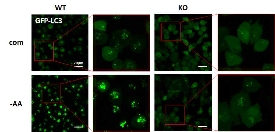 Atg101 KO세포에서 Autophagosome 형성저해 현상