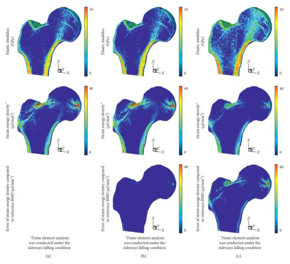 대퇴골의 영률, 변형률 에너지 밀도와 오차율 분포: (a) 원본 BMD를 사용한 경우, (b) 제안 방법을 통해 계산된 BMD를 사용한 경우, (c) HU값 기반의 단순 변환을 사용한 경우