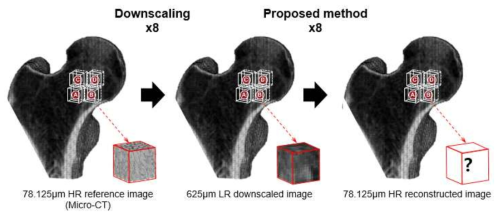 Micro-CT 영상의 다운스케일링과 위상최적설계 기반 고해상화를 통한 골 미세구조 재구성 과정