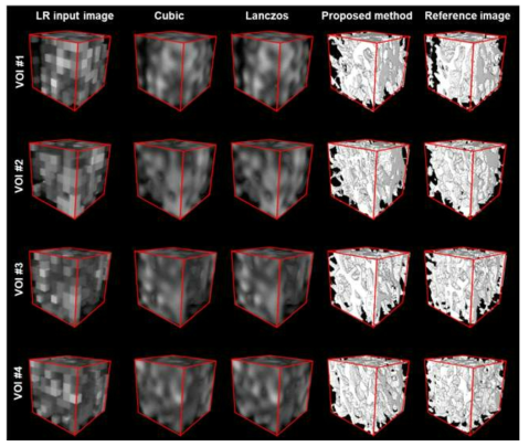 Cubic, Lanczos 및 제안 방법으로 고해상화된 영상과 원본 micro-CT 영상의 비교