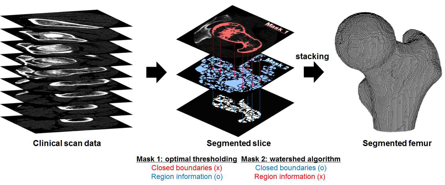 Optimal thresholding과 watershed algorithm 기반의 자동 영상 분할법