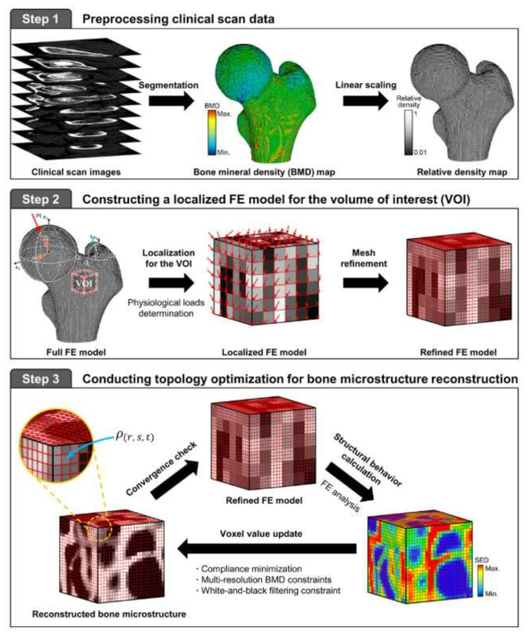 위상최적설계 기반 골격계 영상 국부 고해상화 연구 과정의 개괄 도식