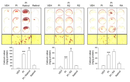 Measurement of calcification by retinoid molecules in primary mouse vascular smooth muscle cells