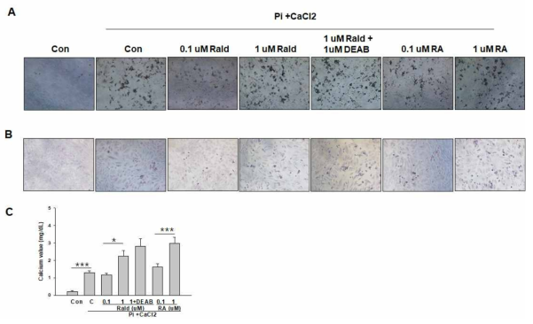 Effect of Retinoids on Pi-induced vascular calcification in A-10 cells. A-10 cells were treated with Pi (2 mM) + CaCl2 (2 mM), followed by incubation with or without Retinaldehyde (Rald), Retinaldehyde + DEAB or Retinoic acid (RA) for 7 days. After incubation for 7 days, the deposition of calcium was analysed using (A) Bright field image, (B) Alizarin red S staining and (C) calcium assay. *p < 0.05 and ***p < 0.001