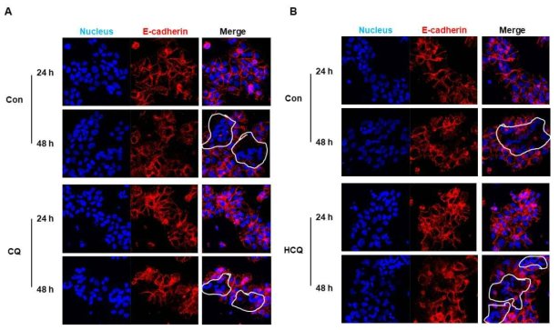 일차 배양한 영양막세포의 CQ (A) 및 HCQ (B) 처리시 syncytial differentiation시 발현이 감소하는 E-cadherin이 다시 증가함을 확인함