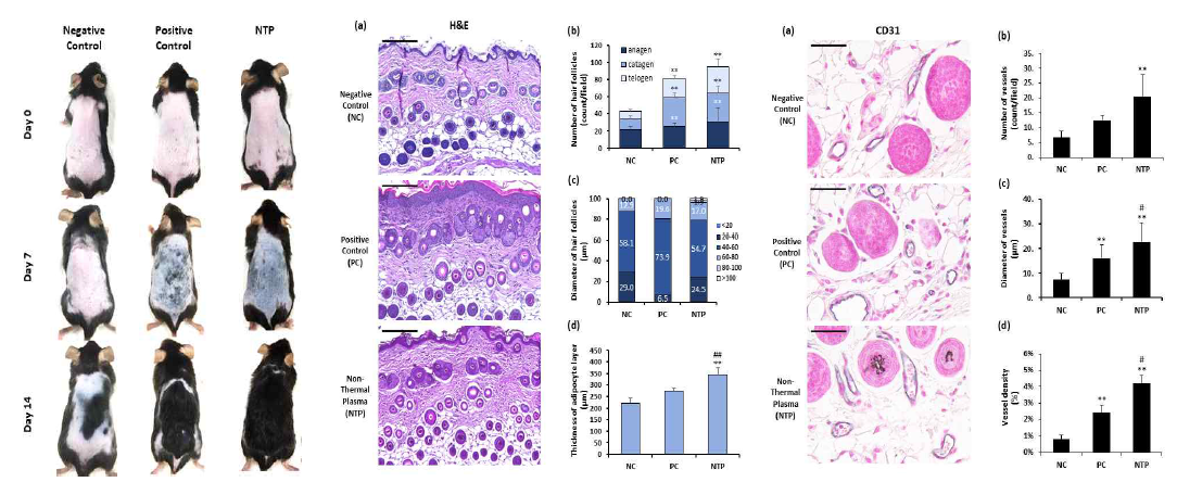 In vivo mouse hair follicle의 성장과 perifollicular vessels에 대한 플라즈마의 효과