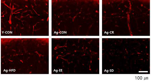 해마(hippocampus) 부위에 RECA-1(red)의 면역 염색을 이용한 미세혈관의 양상 비교 (white scale bar :100㎛)