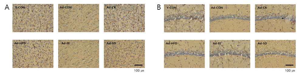 Motor cortex, hippocampus 부분에서 RECA1 (microvessel) 확인