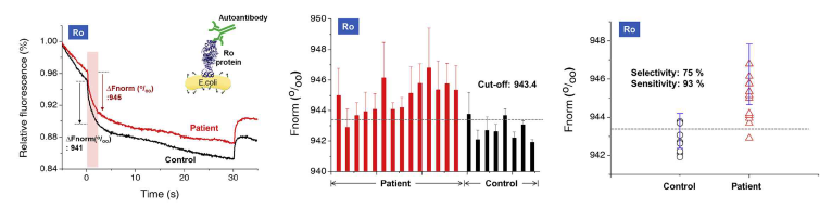 환자시료와 Negative 시료를 이용한 열영동 변화 분석(좌). 환자 시료와 Control 시료 신호 변화(중). ROC 분석에 따른 자가면역질환 진단검사법의 민감도와 선택도 분석 (우)