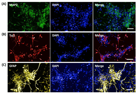 hNPCs의 삼차원 배양에 의한 뇌세포 분화 (A) 신경세포의 dendrite에 localize되는 mature neuron marker인 MAP2의 항체염색. (B) 신경세포의 axon에 localize되는 mature neuron marker인 Tuj1의 항체염색. (C) Mature astrocyte marker인 GFAP 항체염색. (A, B, C) 염색된 단백질 특이적인 visualization을 위하여 GFP 및 RFP와 형광 파장이 중복되지 않는 Cy5 계열의 secondary antibody를 사용하였으며 세포 염색 시료는 30 μm 두께로 z-stack 촬영하였다 (scale bar: 100 μm)