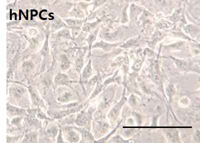 인간신경전구세포 (hNPCs) 신경세포의 특징인 Neurite 구조를 볼 수 있다. 불멸화 세포주로서 배양에 의한 증식이 가능하므로 안정적인 공급이 가능하다. (Scale bar: 200 μm)