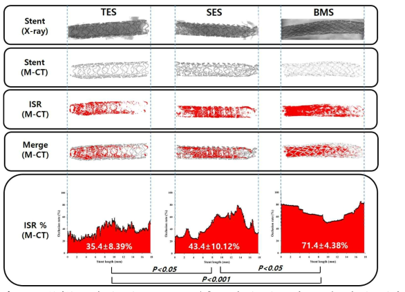 3중약물 스텐트(TES), sirolimus 용출 스텐트(SES) 그리고 금속스텐트(BMS)의 Micro-computed tomography 분석결과