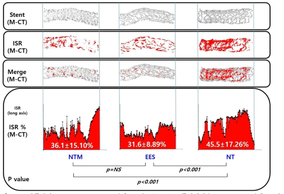 비폴리머 mycophenolic acid 용출 스텐트(NTM), 폴리머사용 everolimus 용출 스텐트 (EES) 그리고 산화티탄박막코팅 스텐트(NT)의 Micro-computed tomography 분석결과