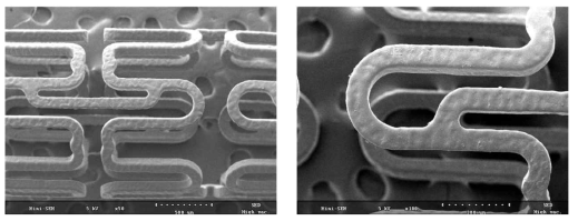 전자 현미경을 이용한 alpha-lipoic acid, sirolimus, 그리고 abciximab 의 3중 약물코팅 스텐트 사진 (좌: X50, 우: X100). 스텐트의 코팅이 균일하게 되어있음을 확인할 수 있음