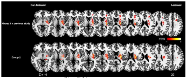 그룹별 Lesion overlapping map