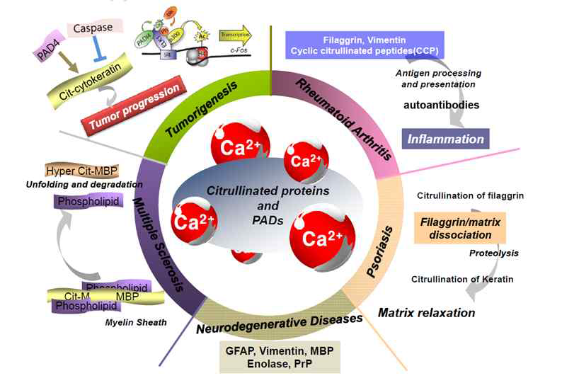 PAD 효소와 시트룰린화 단백의 질환과의 연관성