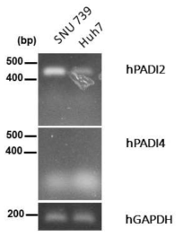 간세포암 세포주 (SNU 739, Huh7) 에서 PAD 효소 (PADI2, PADI4) 발현 증가 확인