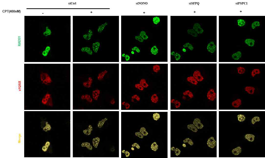 NONO, SFPQ, PSPC1이 각각 결핍된 세포내 CPT 처리 후 RAD51 focus 양 변화를 통한 HR 분석