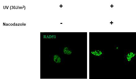 세포내 자외선 조사 후 DNA복제에 따른 RAD51 focus양 변화 분석