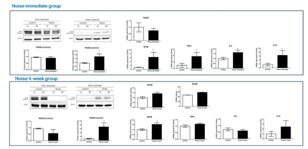 소음 노출 후 RAGE shedding 및 염증관련 인자 발현이 증가함