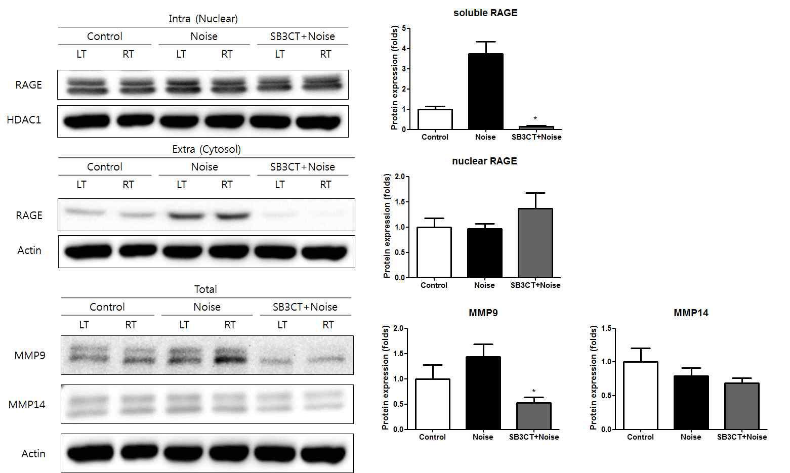 소음 노출 후 MMP9 억제 시 soluble RAGE 가 감소함