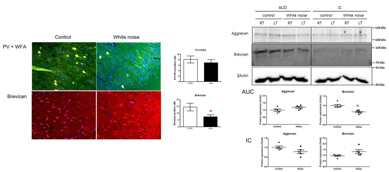 소음성 난청 모델에서 일차 청각피질의 brevican 의 감소가 나타남