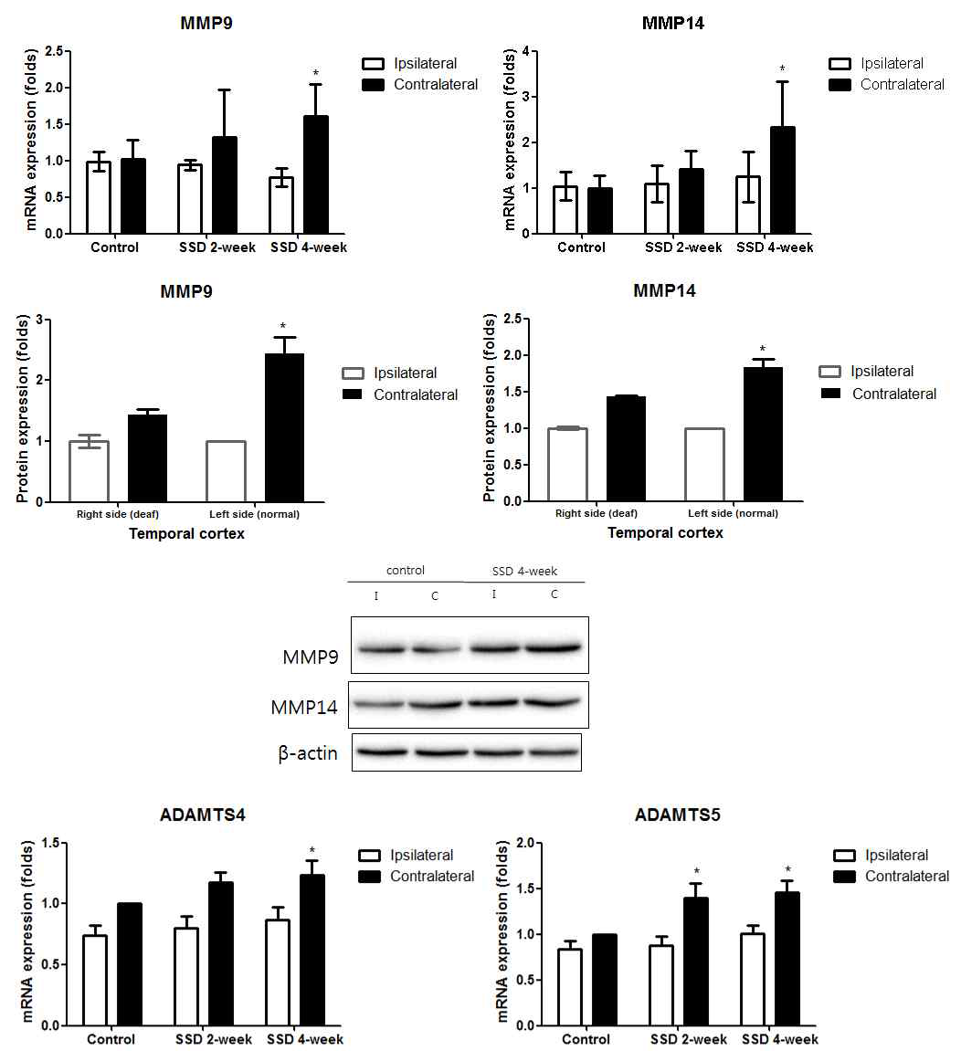 일측성 난청 모델에서 MMP9, MMP14, ADAMTS5 증가가 나타남
