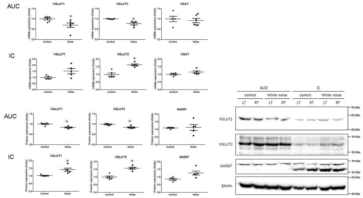 소음성 난청 모델의 일차청각피질과 하구에서의 VGLUT1, VGLUT2, VGAT의 발현변화