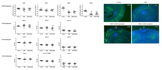 narrowband 소음 노출 후 chondroitinase ABC 투여 후 청력에 변화가 없었음