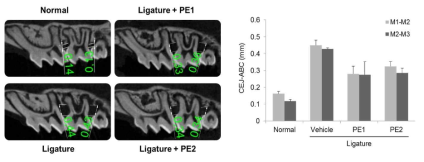 Effects of Korean propolis extracts on alveolar bone loss in ligature-induced periodontitis mouse model