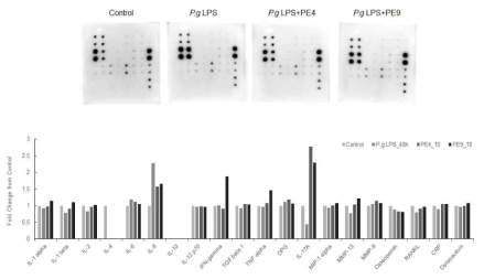 Change of periodontal disease-related cytokines in PDLSCs