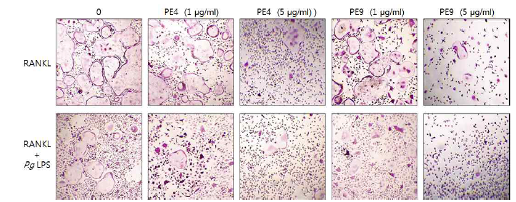 Effects of Korean propolis extracts on RANKL or P.g LPS-induced osteoclast differentiation in mouse bone marrow macrophages