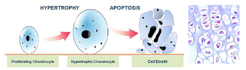 비후는 정상적으로 성장판에서 연골세포가 분화 후 크기가 커지면서 apoptosis 되는 현상으로 관절연골세포에서는 일어나지 않음