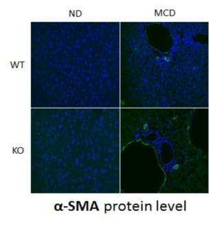 IDH2 WT 쥐의 간과 IDH2 KO 쥐의 간에서의 간 섬유화 수준 차이