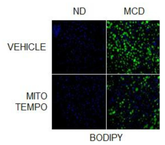 MitoTEMPO를 투여한 쥐의 간에서와 투여하지 않은 쥐의 간에서의 중성지방 수준 차이 2