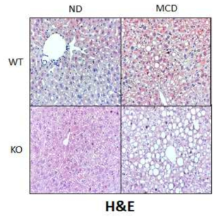 IDH2 WT 쥐의 간과 IDH2 KO 쥐의 간에서의 중성지방 및 염증 수준 차이