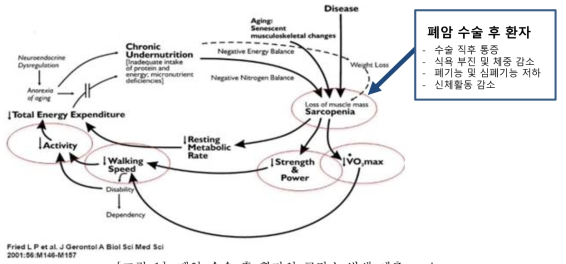 . 폐암 수술 후 환자의 근감소 발생 예측 cycle