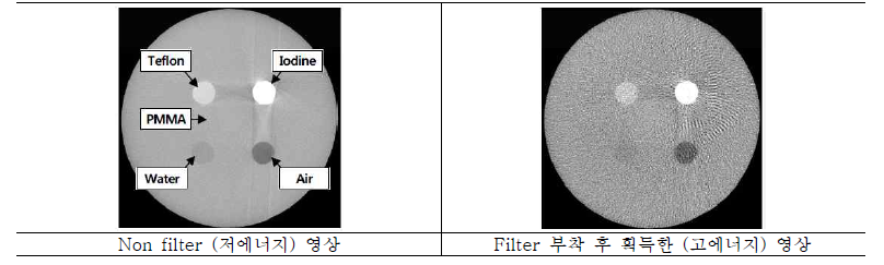 저에너지 및 고에너지 획득 영상 비교