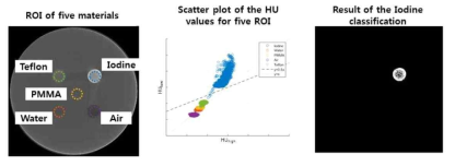 인체 구성 물질을 분별할 수 있는 물질 분별 알고리즘 적용 영상