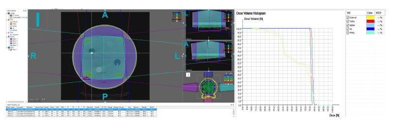 인체 등가 팬텀을 이용한 방사선 치료 계획 수립 및 DVH 평가