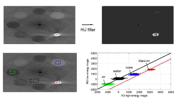 이중에너지 콘빔 CT 영상에서 물질 구성 원소 차이가 큰 titanium 물질 추출