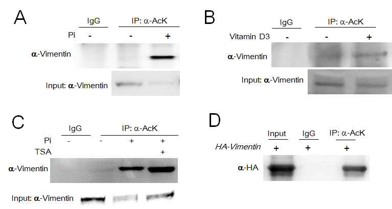 석회화 모델에서 vimentin acetylation (A) 혈관 평활근 세포에 Pi 자극에 의한 혈관 석회화 모델에서 vimentin acetylation 확인 (B) 생쥐에 vitamin D3에 의해 유도된 혈관 석회화 모델에서 vimentin acetylation 확인 (C) Pi 처리에 의해 증가된 vimentin acetylation이 TSA에 의해 더 증가됨 (D) vimentin 과발현 세포에서 vimentin acetylation 확인