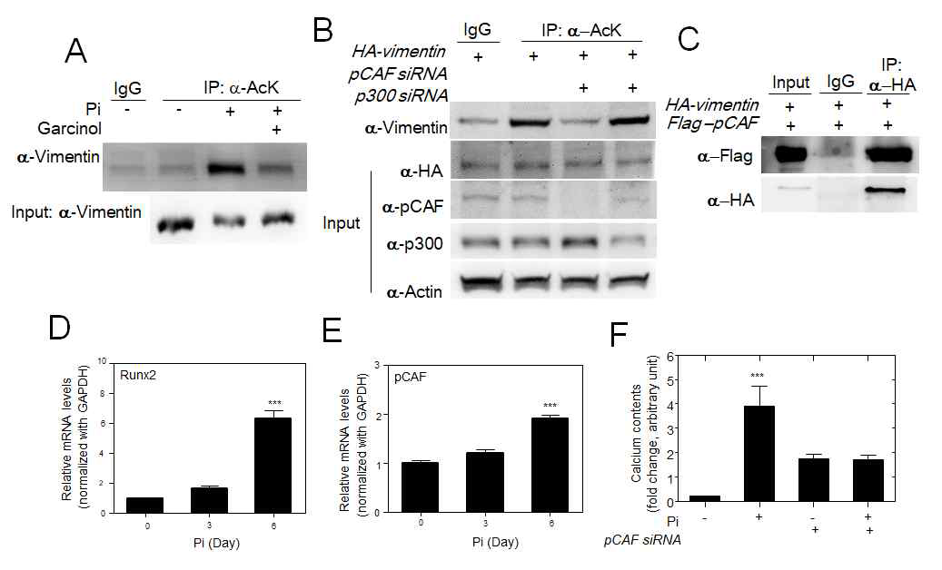 pCAF에 의한 vimentin acetylation 확인 (A) Pi에 의해 유 도된 혈관 석회화 모델에서 vimentin 의 acetylation이 garcinol에 의해 차단됨을 확인 (B) pCAF kncdown 에 의해 증가된 vimentin acetylation이 p300 knockdown에 의해서는 변화없음 (C) vimentin과 pCAF 결합확인 (D) 혈관 석회화 모델에서 runx2 mRNA 발현 증가 확인 (E) 혈관 석회화 모델에서 pCAF mRNA 증가 확인 (F) Pi 자극에 의해 증가된 calcium 침착이 pCAF knockdown에 의해 차단됨을 확인함