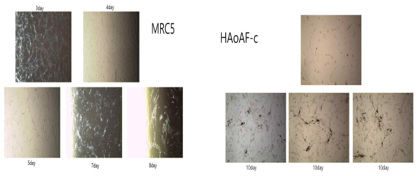 VZV infected MRC5 (lung fibroblasts) and human aortic adventitial fibroblast